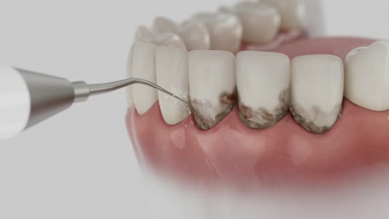 Reliable Tooth Extraction contractor in Mendon, IL by Smile Center Dentistry